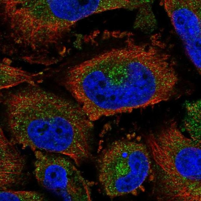 CHST3 Antibody in Immunocytochemistry (ICC/IF)