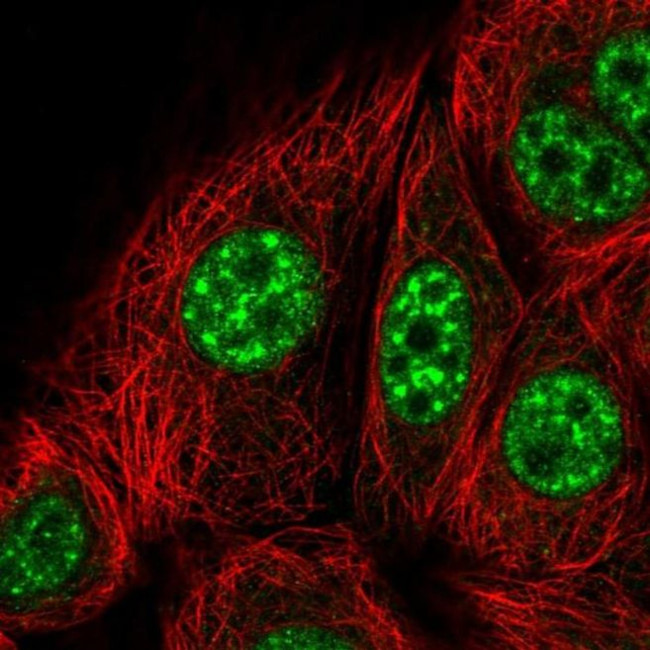 KID Antibody in Immunocytochemistry (ICC/IF)