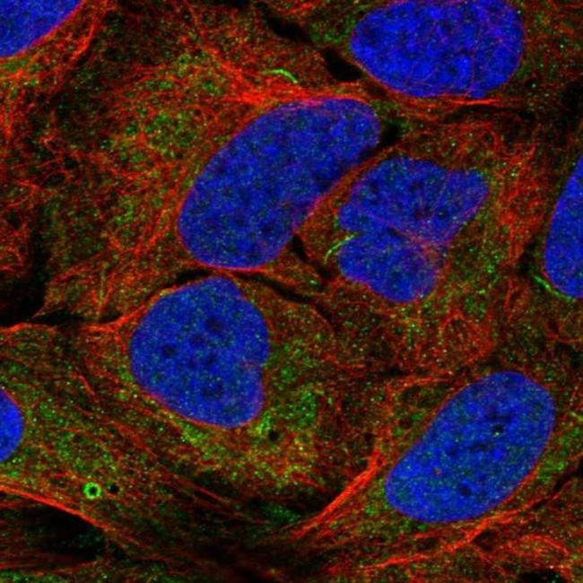 AGPAT1 Antibody in Immunocytochemistry (ICC/IF)