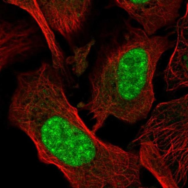 AES Antibody in Immunocytochemistry (ICC/IF)