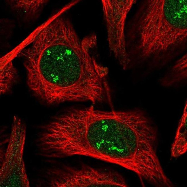 POLR1A Antibody in Immunocytochemistry (ICC/IF)