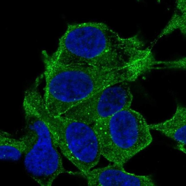 SYNPO2 Antibody in Immunocytochemistry (ICC/IF)