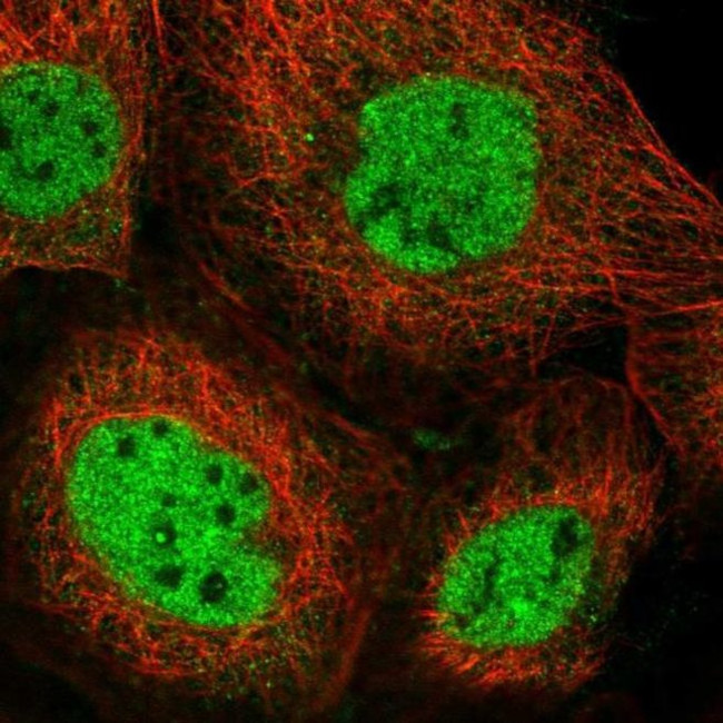 NCOA6 Antibody in Immunocytochemistry (ICC/IF)