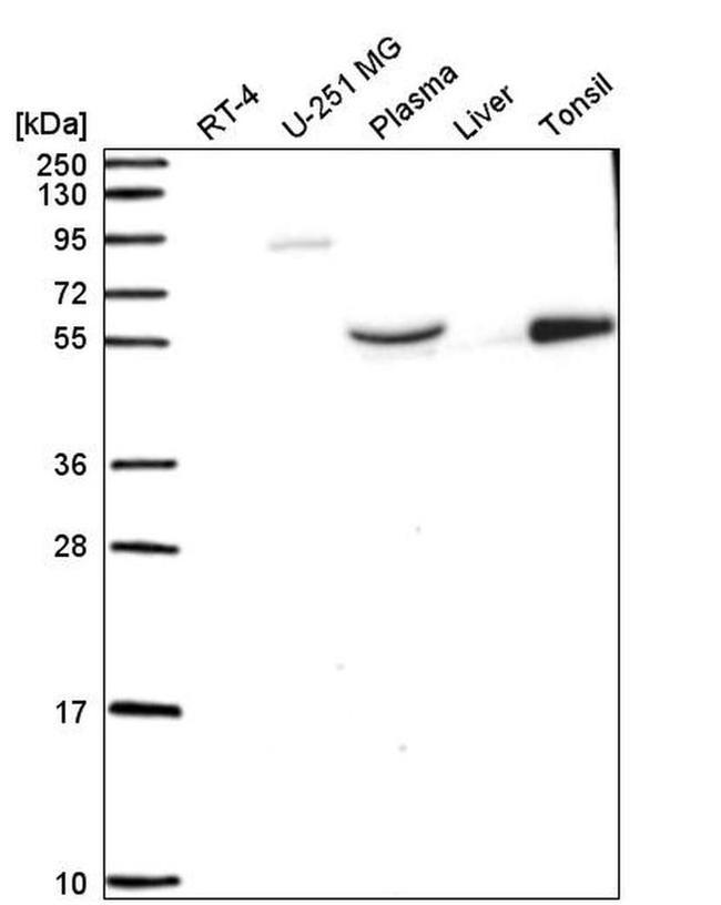 BRF1 Antibody in Western Blot (WB)