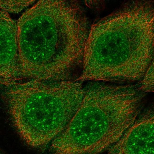 SERPINB13 Antibody in Immunocytochemistry (ICC/IF)