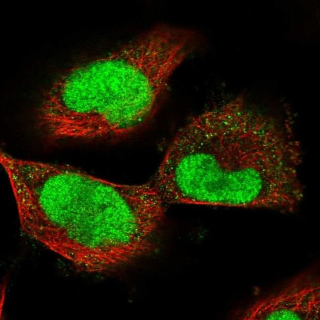 ECT2 Antibody in Immunocytochemistry (ICC/IF)