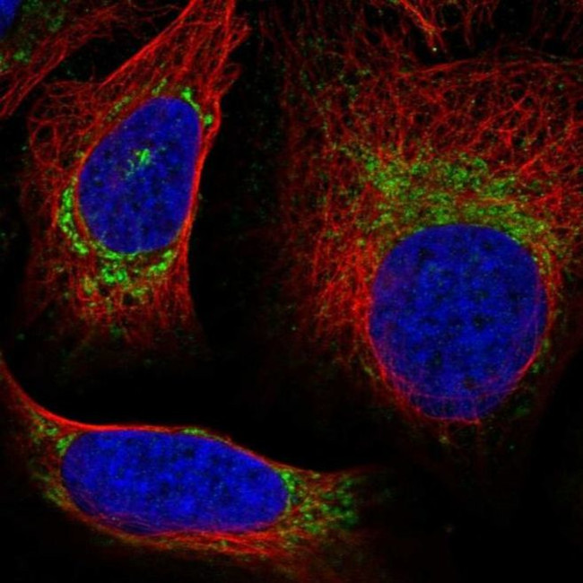 UQCRQ Antibody in Immunocytochemistry (ICC/IF)