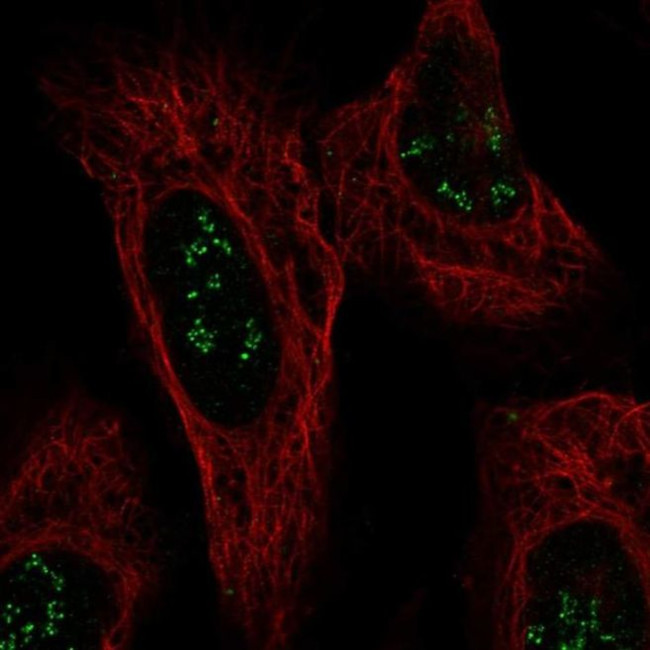 ISPD Antibody in Immunocytochemistry (ICC/IF)