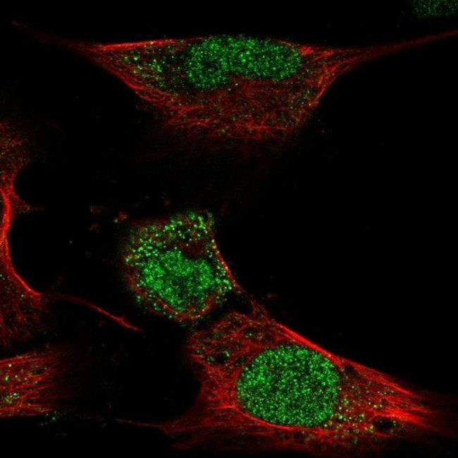 HOXC4 Antibody in Immunocytochemistry (ICC/IF)