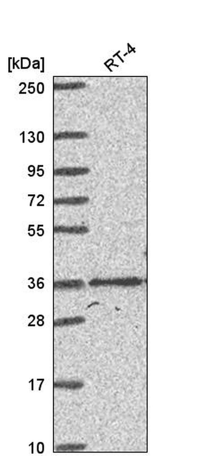 HOXC4 Antibody in Western Blot (WB)