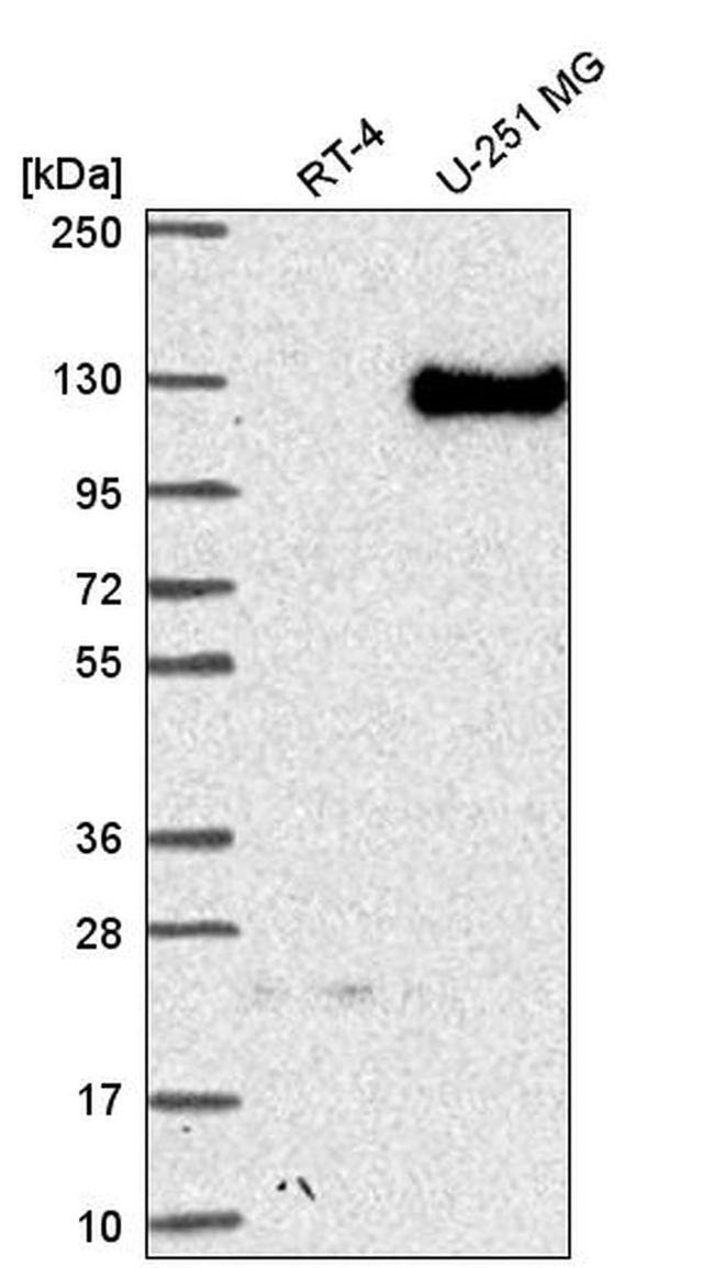 Neuropilin 2 Antibody in Western Blot (WB)