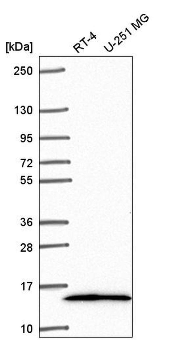 NR2C2AP Antibody in Western Blot (WB)