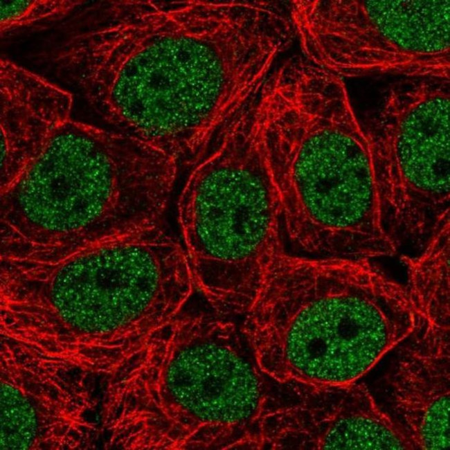 CHTF18 Antibody in Immunocytochemistry (ICC/IF)