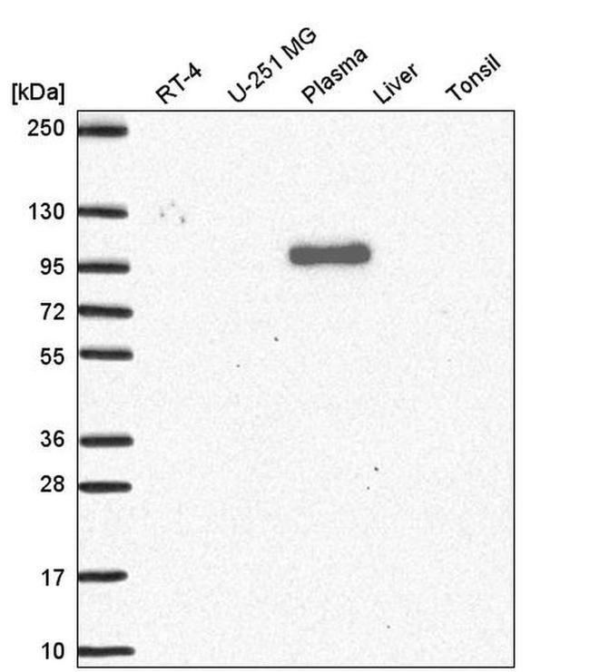 QSOX1 Antibody in Western Blot (WB)