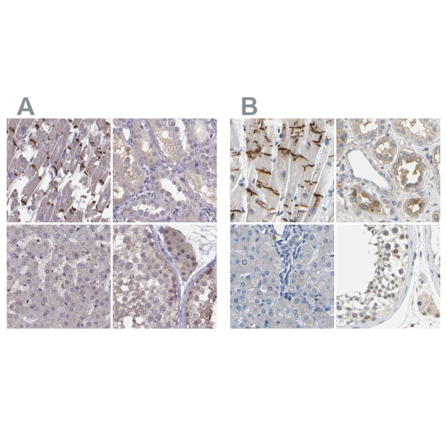 PKP2 Antibody in Immunohistochemistry (IHC)