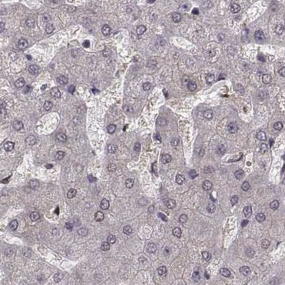 PKP2 Antibody in Immunohistochemistry (IHC)