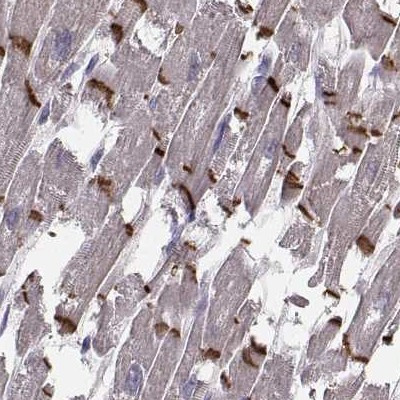 PKP2 Antibody in Immunohistochemistry (IHC)