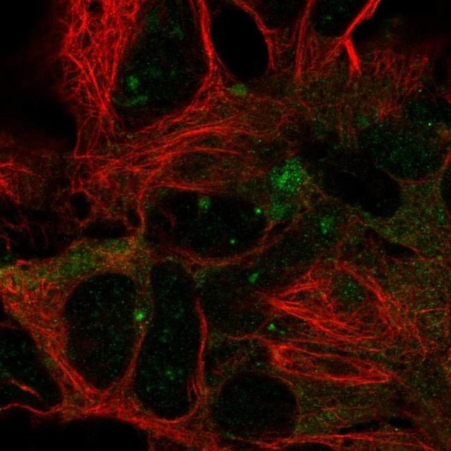 DYNC1LI2 Antibody in Immunocytochemistry (ICC/IF)