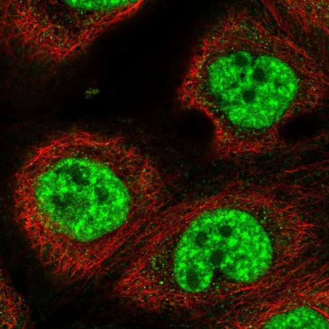 RBM10 Antibody in Immunocytochemistry (ICC/IF)