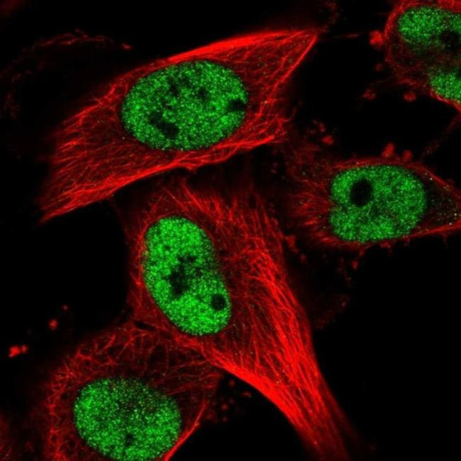 RBM15B Antibody in Immunocytochemistry (ICC/IF)