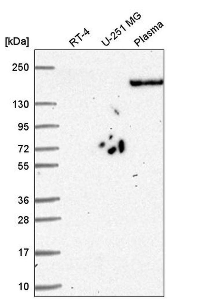 PLXNA3 Antibody in Western Blot (WB)