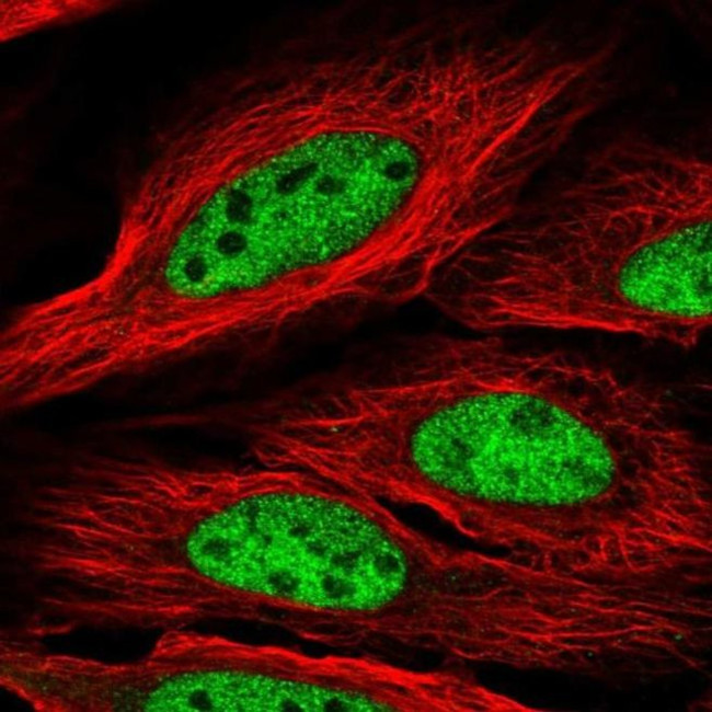 CCDC174 Antibody in Immunocytochemistry (ICC/IF)