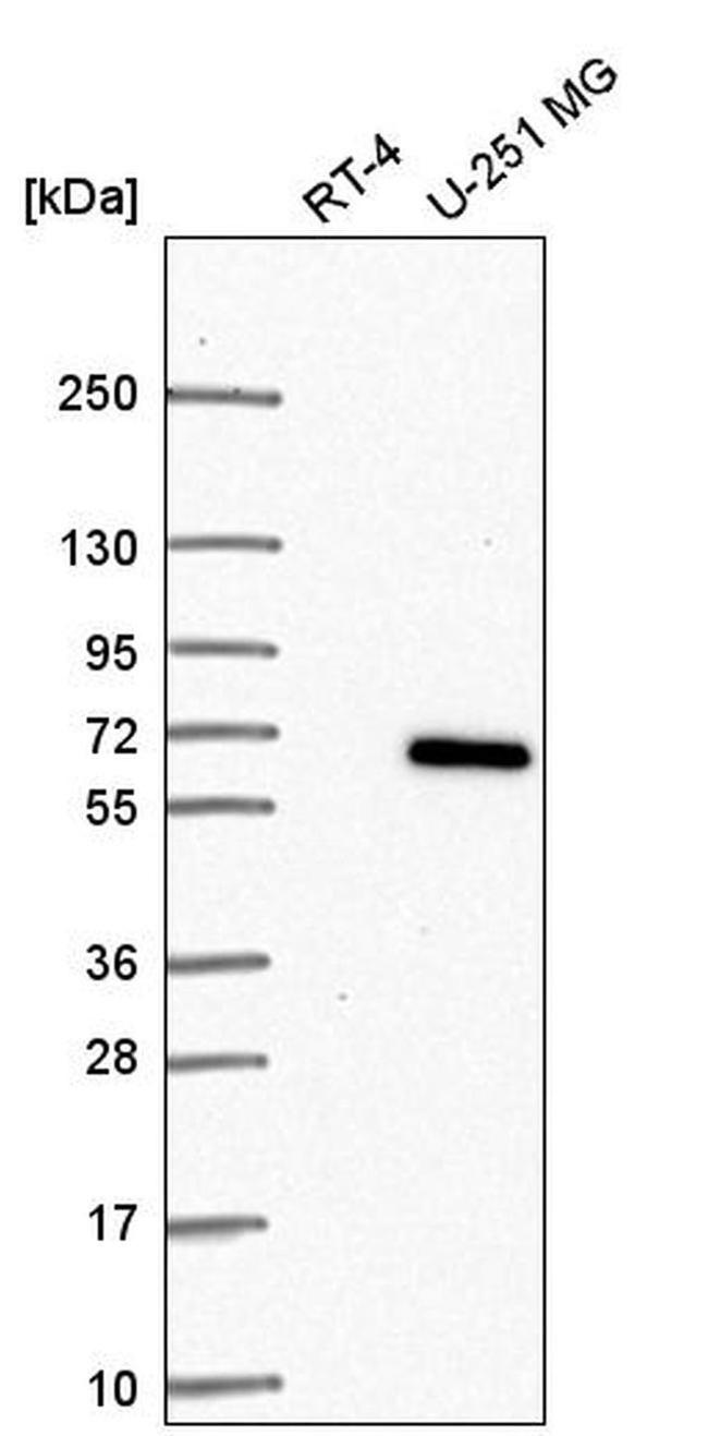 CCDC64 Antibody in Western Blot (WB)
