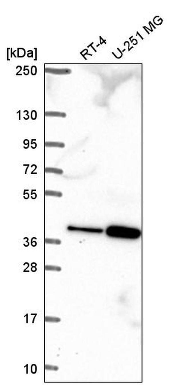 TPGS2 Antibody in Western Blot (WB)