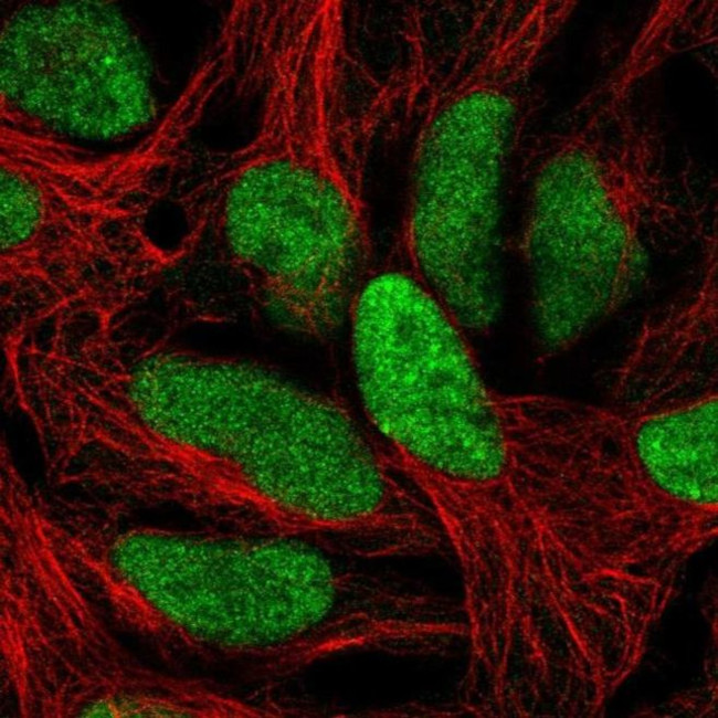 CA052 Antibody in Immunocytochemistry (ICC/IF)