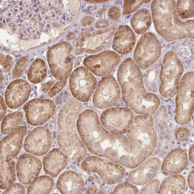 COX14 Antibody in Immunohistochemistry (IHC)