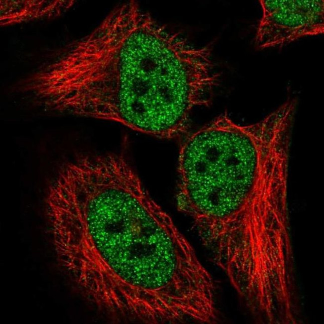 CDKN2AIP Antibody in Immunocytochemistry (ICC/IF)