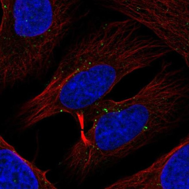 TXK Antibody in Immunocytochemistry (ICC/IF)