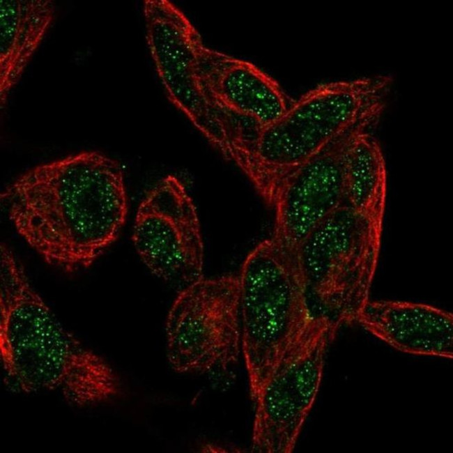 CTDSP1 Antibody in Immunocytochemistry (ICC/IF)