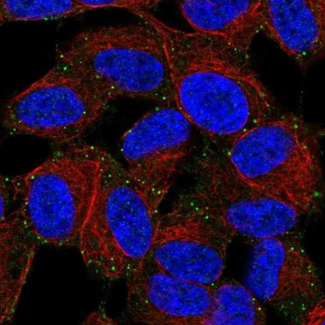 LIMD2 Antibody in Immunocytochemistry (ICC/IF)