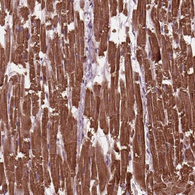 MYL3 Antibody in Immunohistochemistry (IHC)