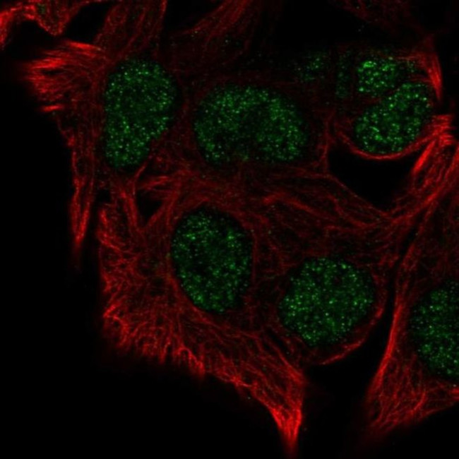 SUV420H1 Antibody in Immunocytochemistry (ICC/IF)