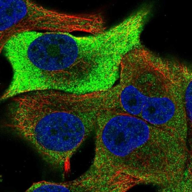 TRIB1 Antibody in Immunocytochemistry (ICC/IF)