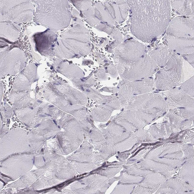 POLI Antibody in Immunohistochemistry (IHC)