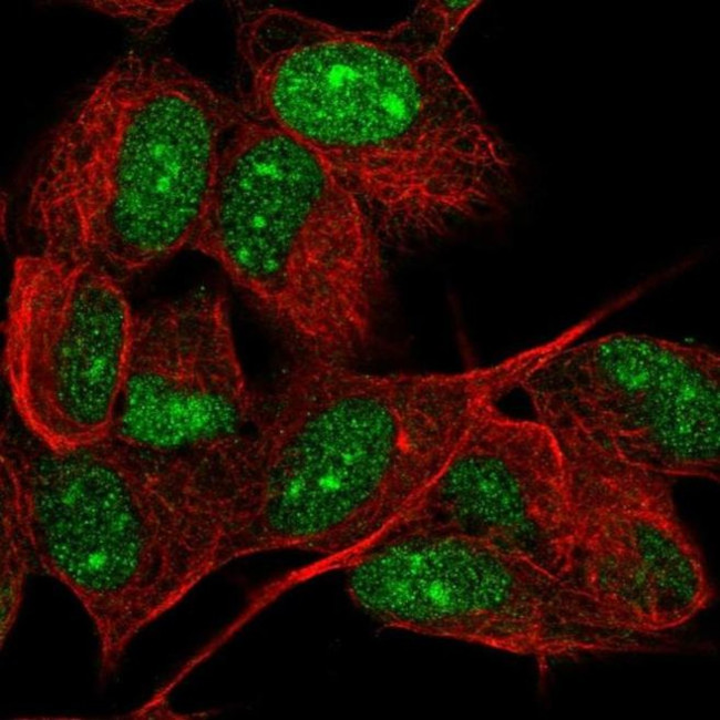 PHF16 Antibody in Immunocytochemistry (ICC/IF)