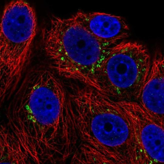 POMT1 Antibody in Immunocytochemistry (ICC/IF)