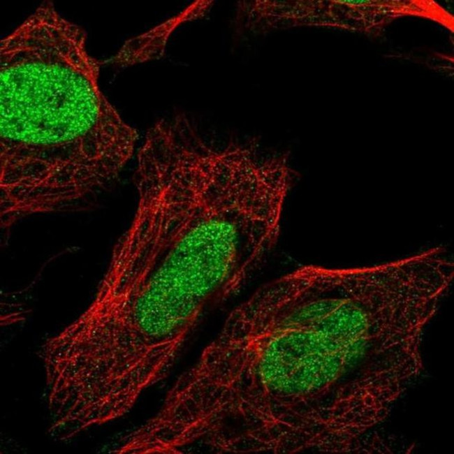 CHTF8 Antibody in Immunocytochemistry (ICC/IF)