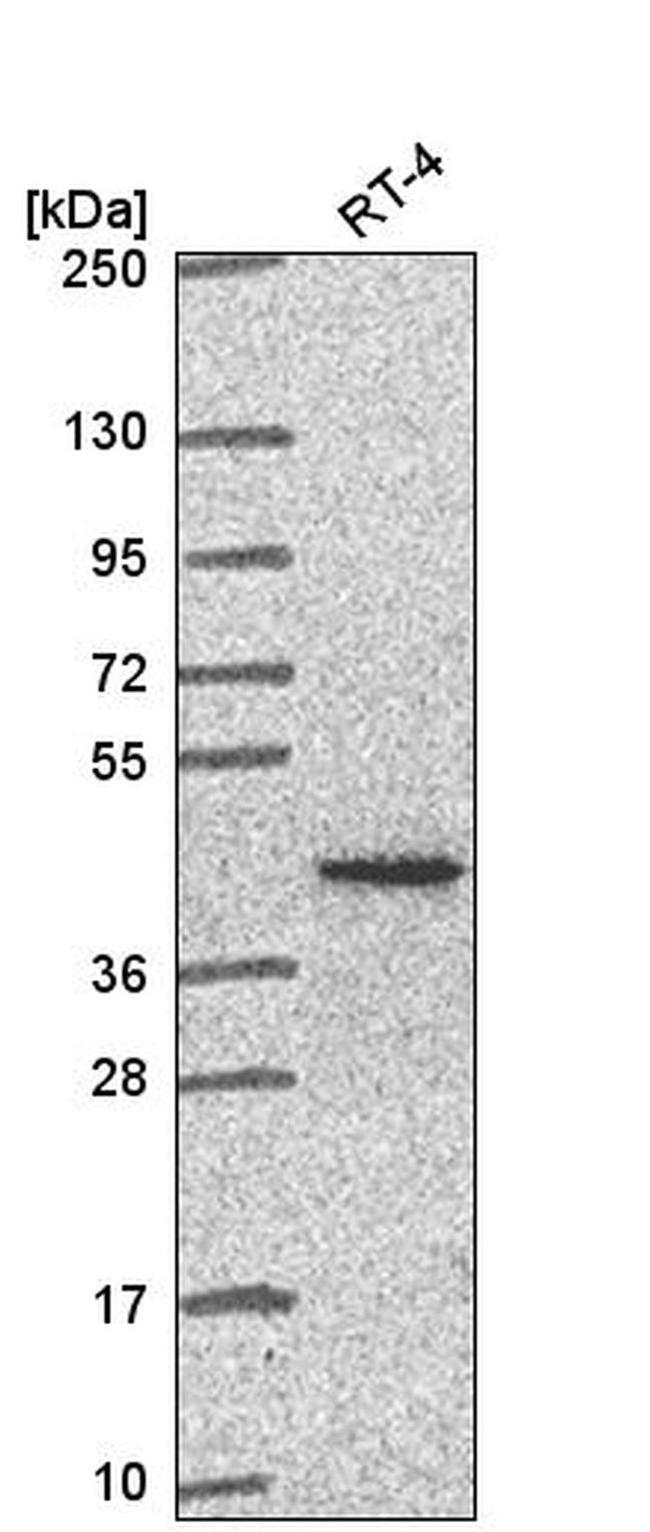 PCBP1 Antibody in Western Blot (WB)