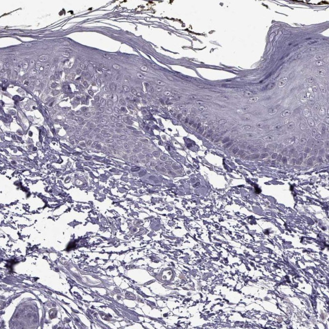 SYNPO2 Antibody in Immunohistochemistry (IHC)