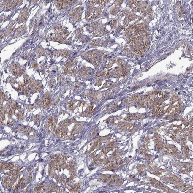 SYNPO2 Antibody in Immunohistochemistry (IHC)