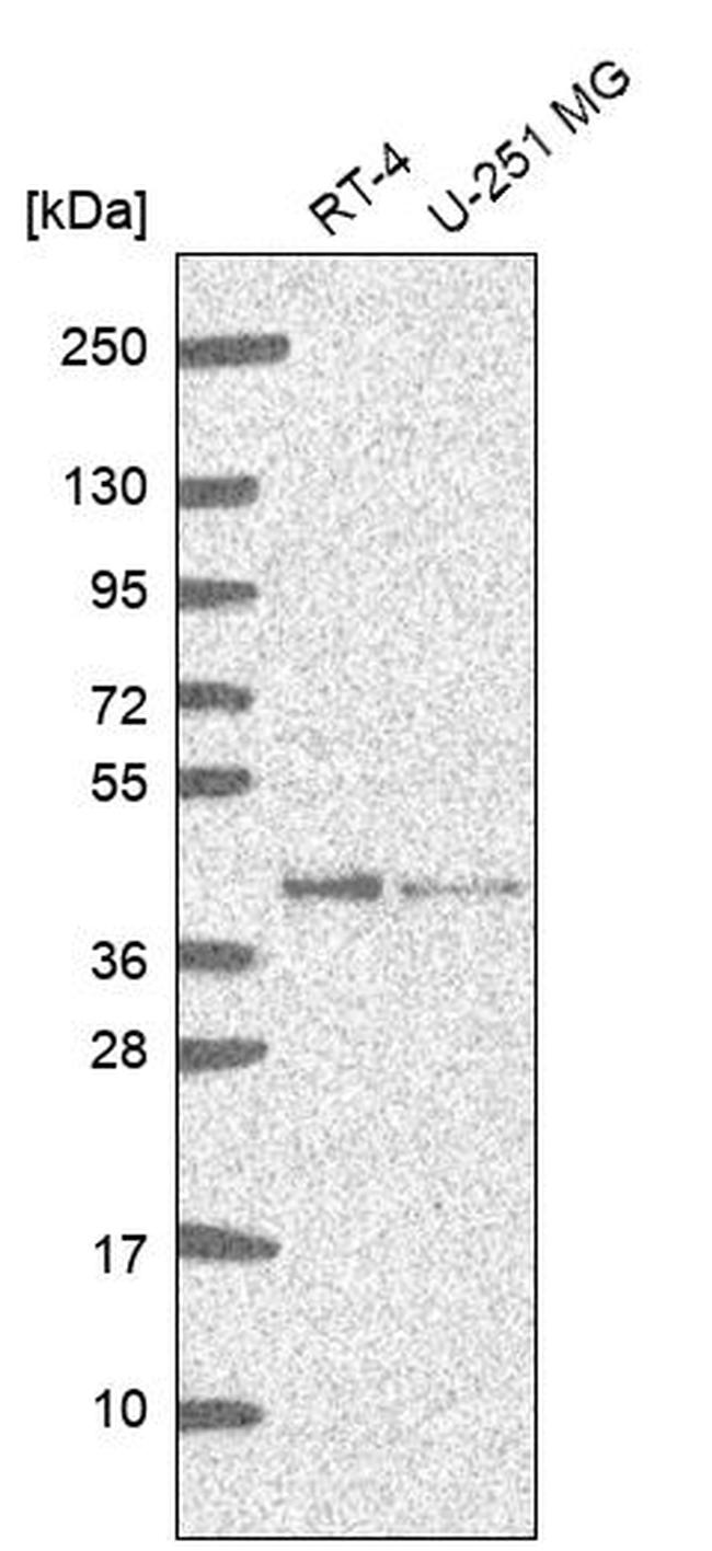 GMPR2 Antibody in Western Blot (WB)