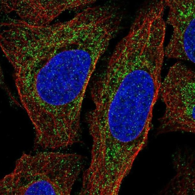 MTERF Antibody in Immunocytochemistry (ICC/IF)