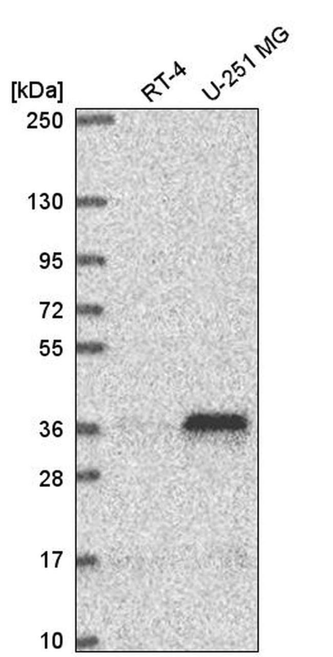 MTERF Antibody in Western Blot (WB)