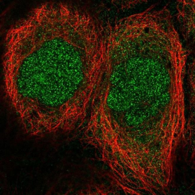 MESP1 Antibody in Immunocytochemistry (ICC/IF)