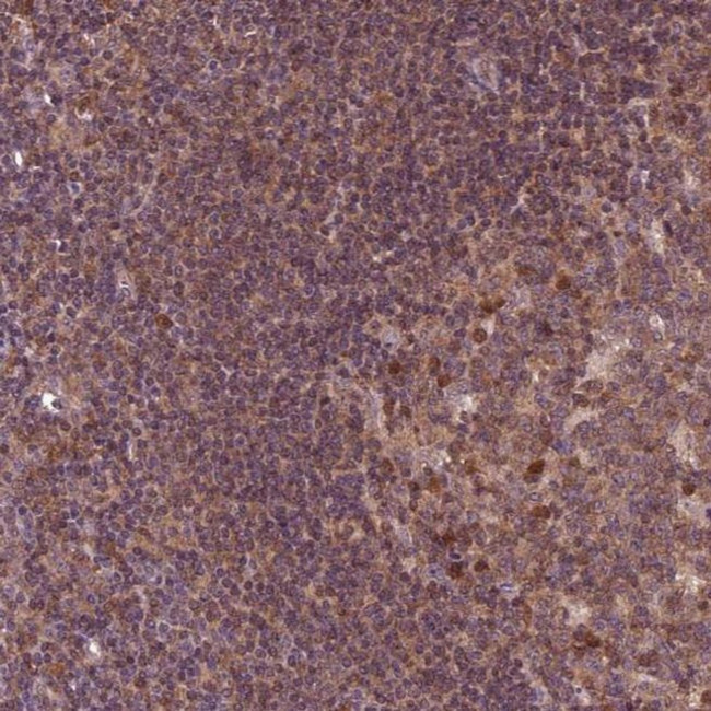 MDP1 Antibody in Immunohistochemistry (IHC)