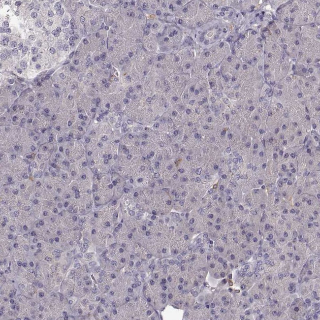 Cyclin F Antibody in Immunohistochemistry (IHC)